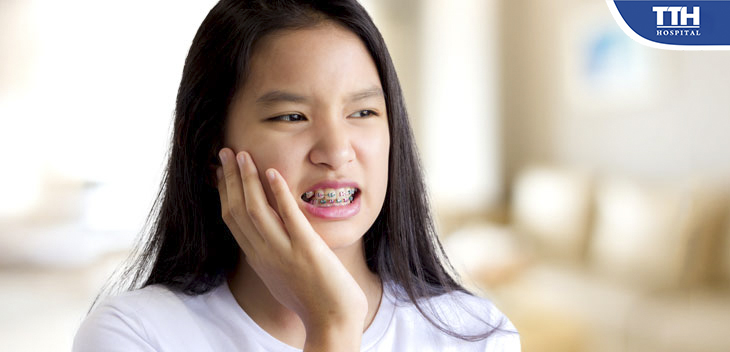 Đau nhức khi niềng là hiện tượng thường gặp