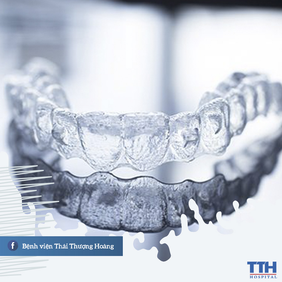 Niềng răng trong suốt Invisalign là gì?