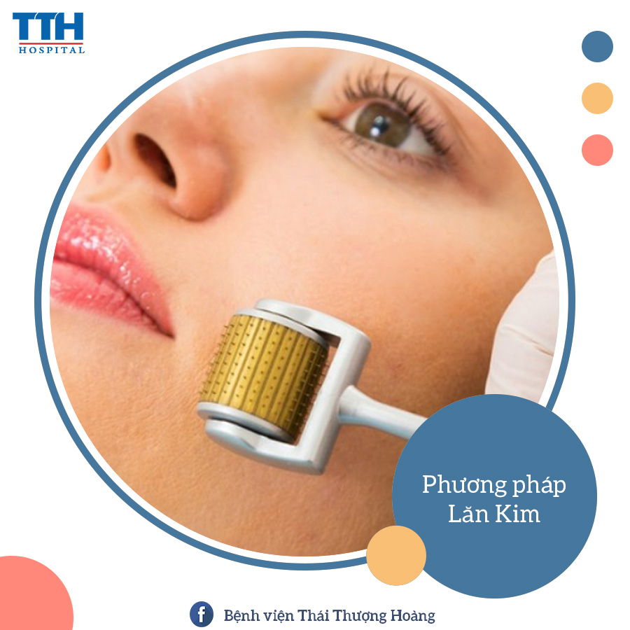 PHƯƠNG PHÁP ĐIỀU TRỊ