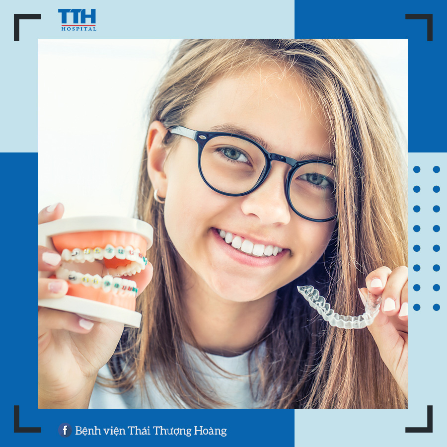Niềng răng Invisalign mất nhiều thời gian hơn các phương pháp niềng răng truyền thống