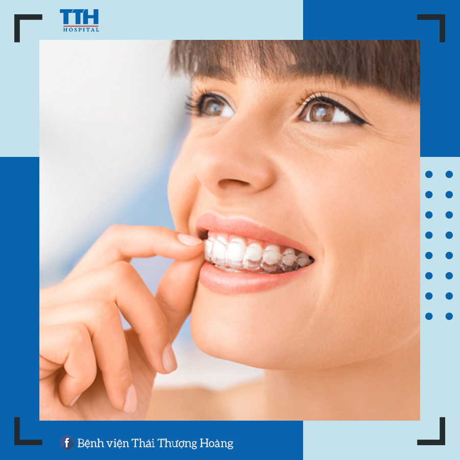 Mang khay niềng Invisalign sẽ khiến bạn gặp khó khăn trong giao tiếp
