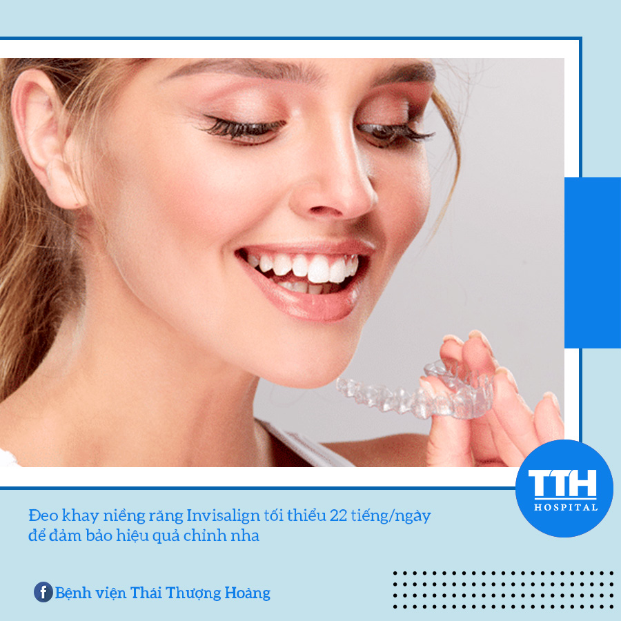 Đeo khay niềng răng Invisalign tối thiểu 22 tiếng/ngày để đảm bảo được hiệu quả chỉnh nha 