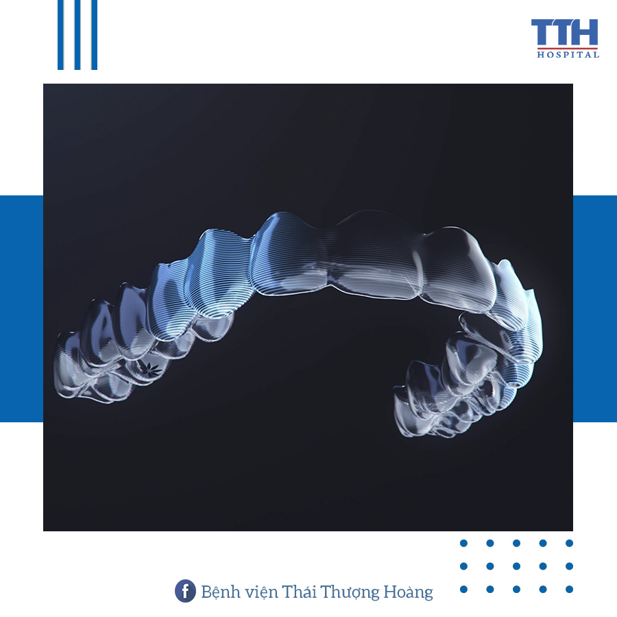 NIỀNG RĂNG TRONG SUỐT LÀ GÌ?