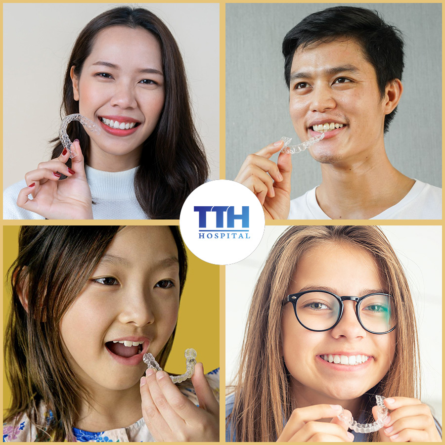 Invisalign có phù hợp cho cả người lớn và trẻ em không?