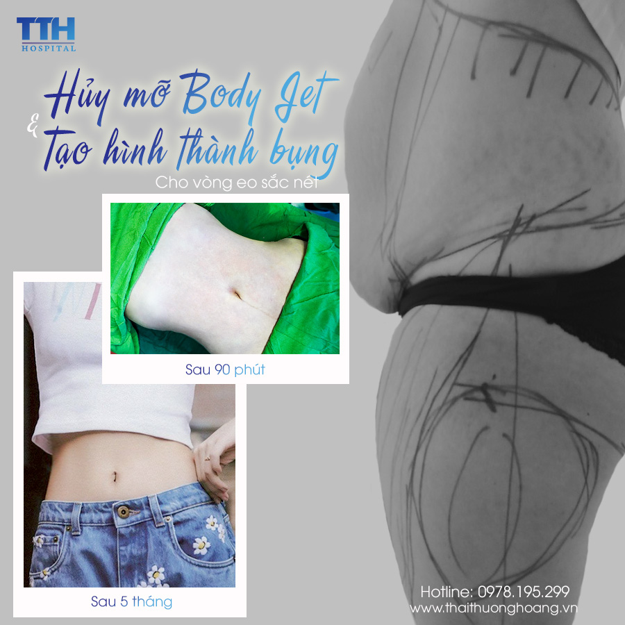 Hủy mỡ Body Jet và tạo hình thành bụng thường sẽ được thực hiện cùng nhau để mang lại hiệu quả tối ưu