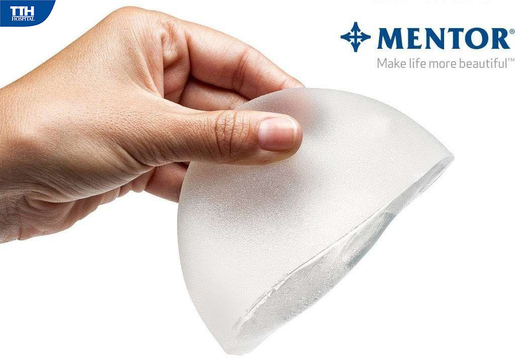 Nâng ngực nội soi túi Mentor MemoryGel Xtra
