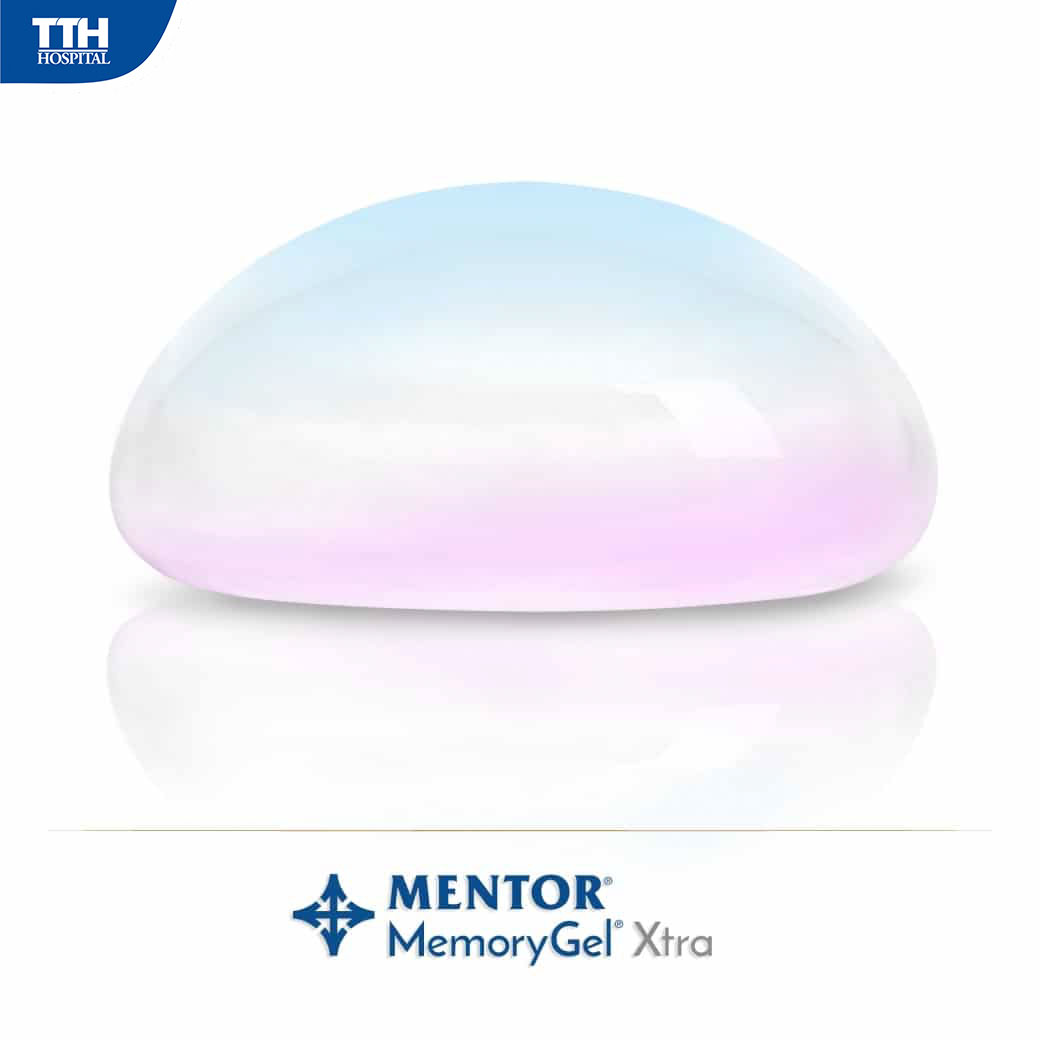 Nâng ngực nội soi túi Motiva Nano Chip
