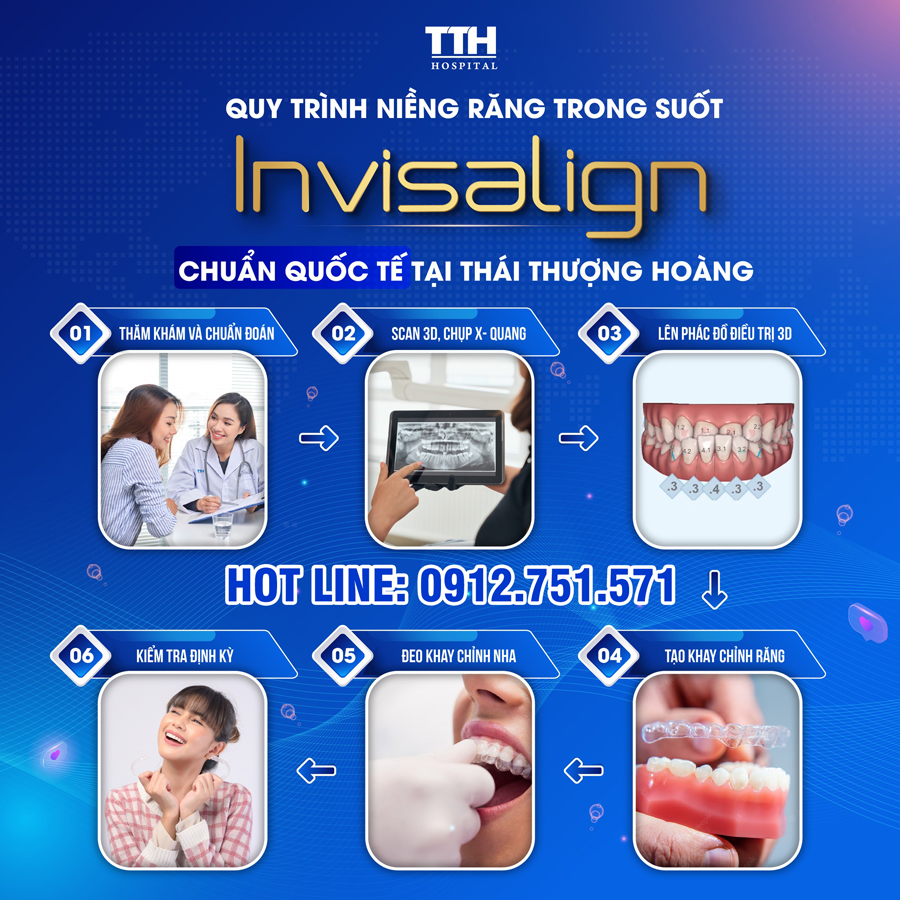 Quy trình niềng răng tại bệnh viện Thái Thượng Hoàng