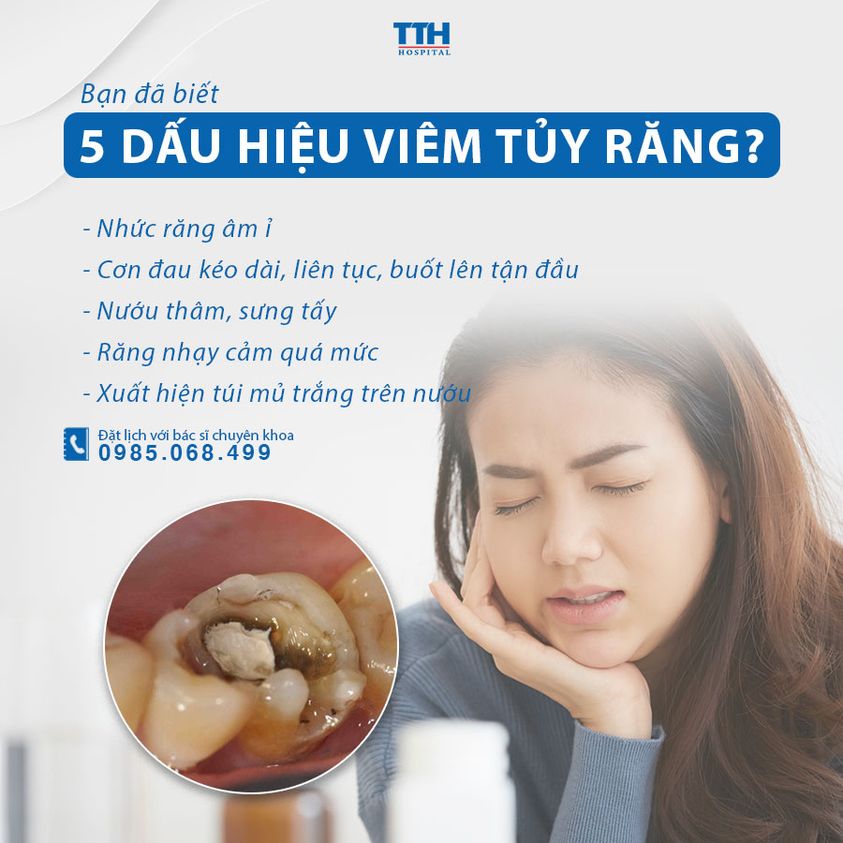 5 dấu hiệu của viêm tủy răng