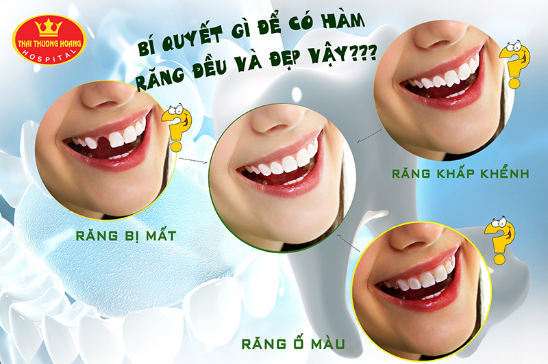Trường hợp nào cần bọc răng sứ?