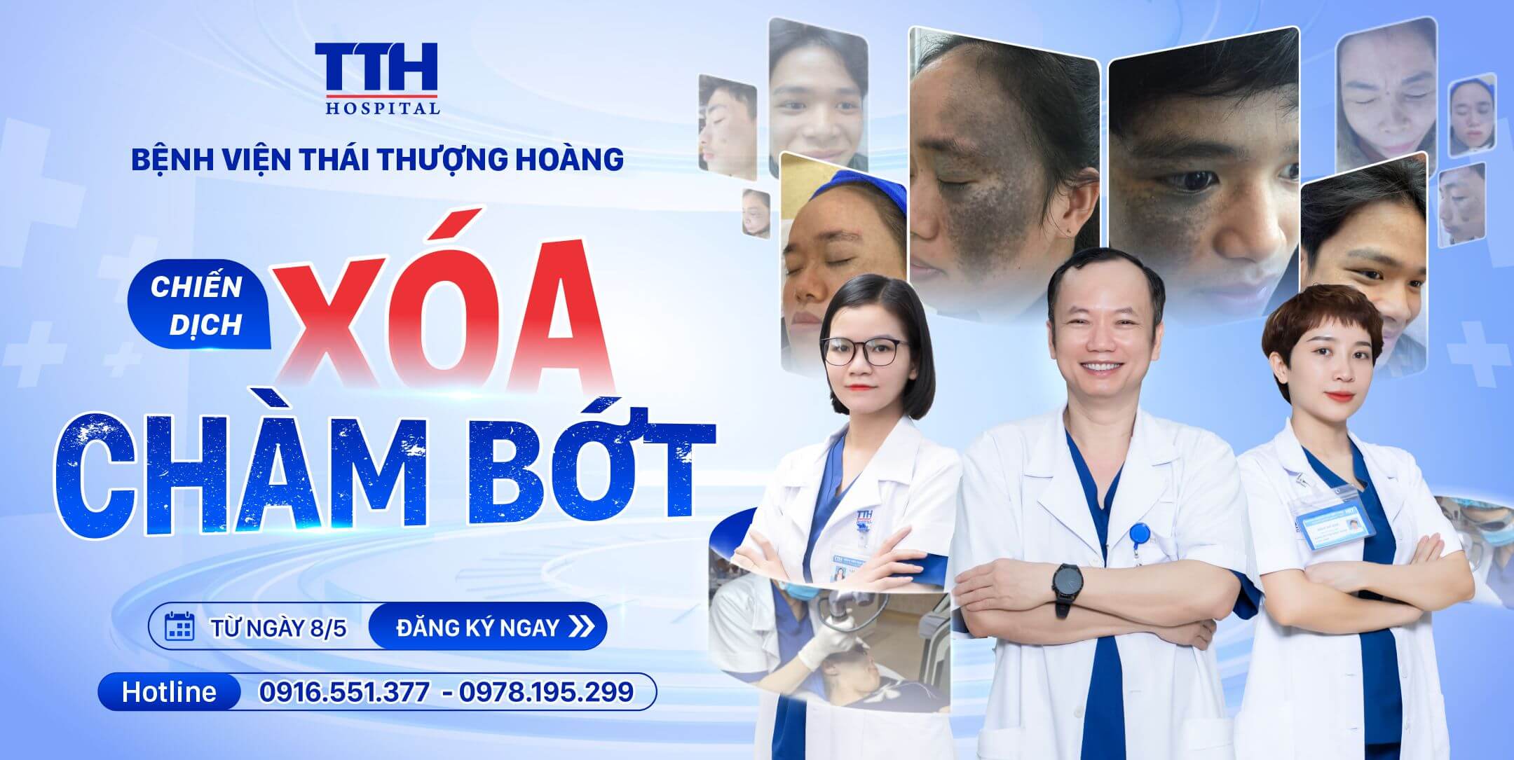 CHƯƠNG TRÌNH XÓA CHÀM BỚT MIỄN PHÍ TRỊ GIÁ 500 TRIỆU ĐỒNG