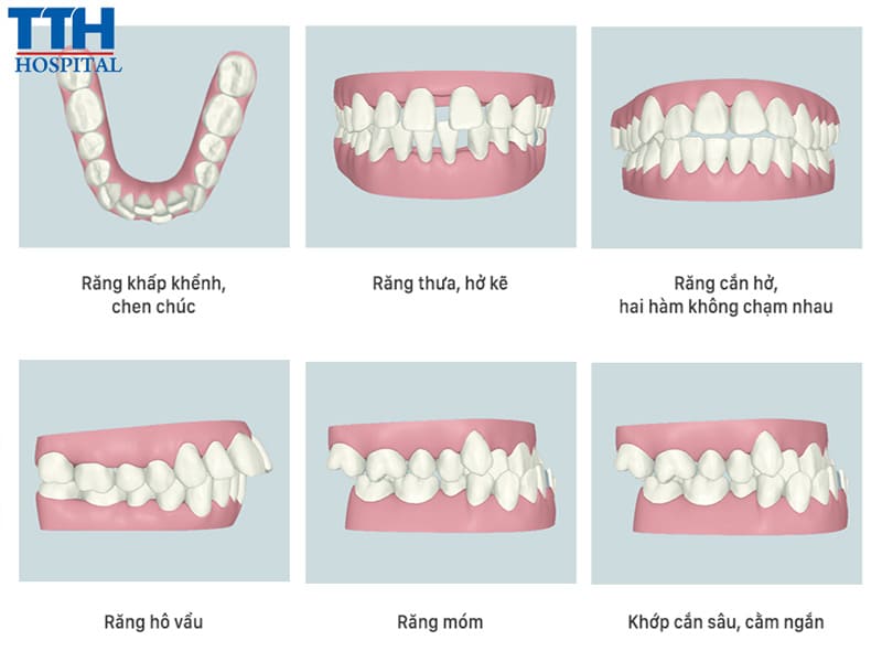 Cải thiện các vấn đề răng miệng
