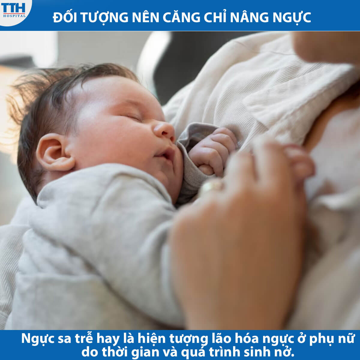 Đối tượng nên căng chỉ nâng ngực