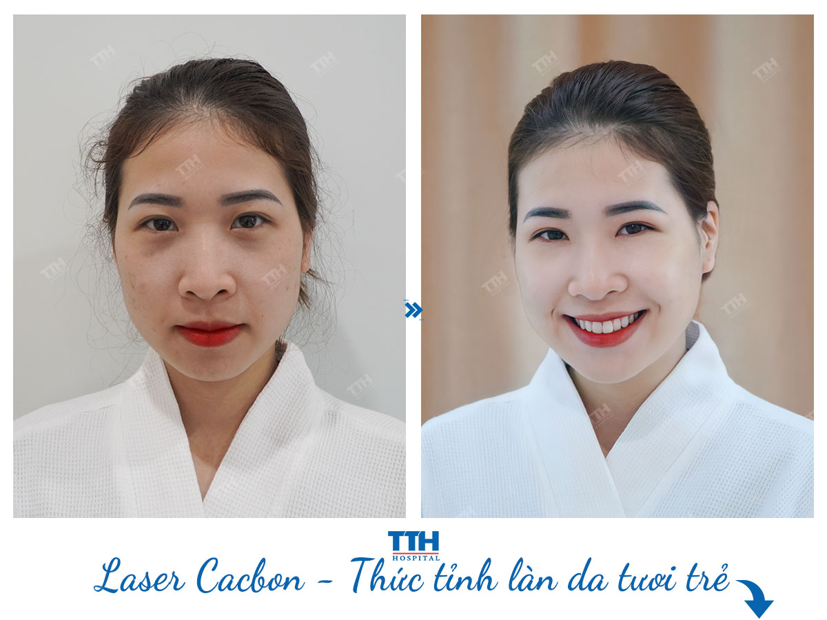 Làn da trẻ sẽ dễ chăm sóc hơn so với làn da lão hóa