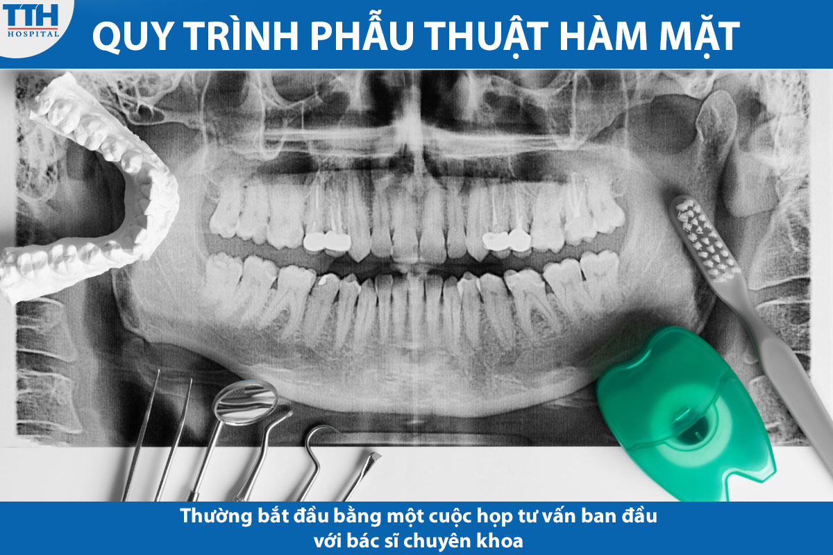 Quy trình phẫu thuật hàm mặt an toàn