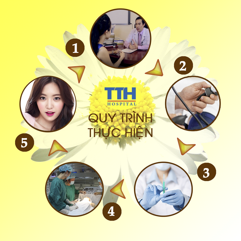 Quy trình thực hiện