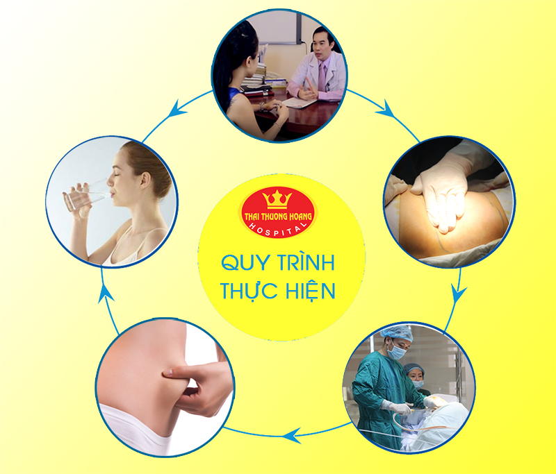 Quy trình hút mỡ Body Jet tại Bệnh viện Thái Thượng Hoàng