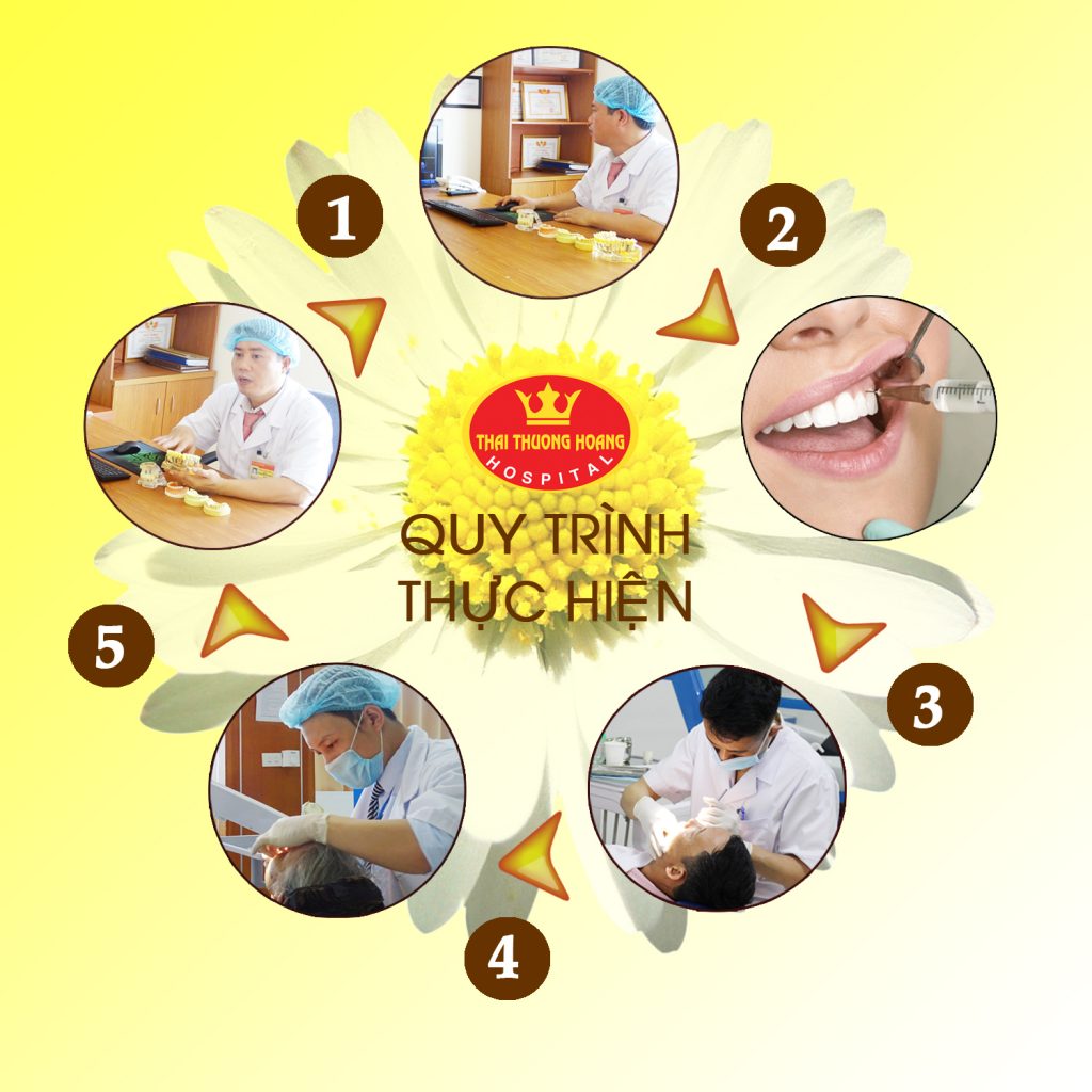 Quy trình điều trị tủy răng kỹ thuật cao tại Bệnh viện Thái Thượng Hoàng