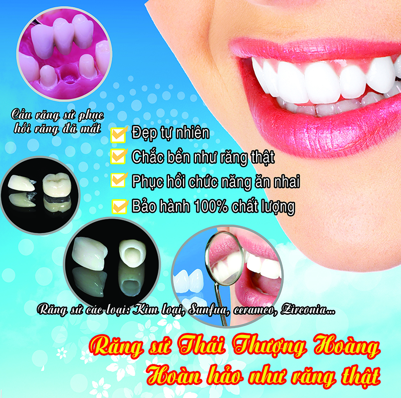 Ưu điểm của phương pháp bọc răng sứ thẩm mỹ