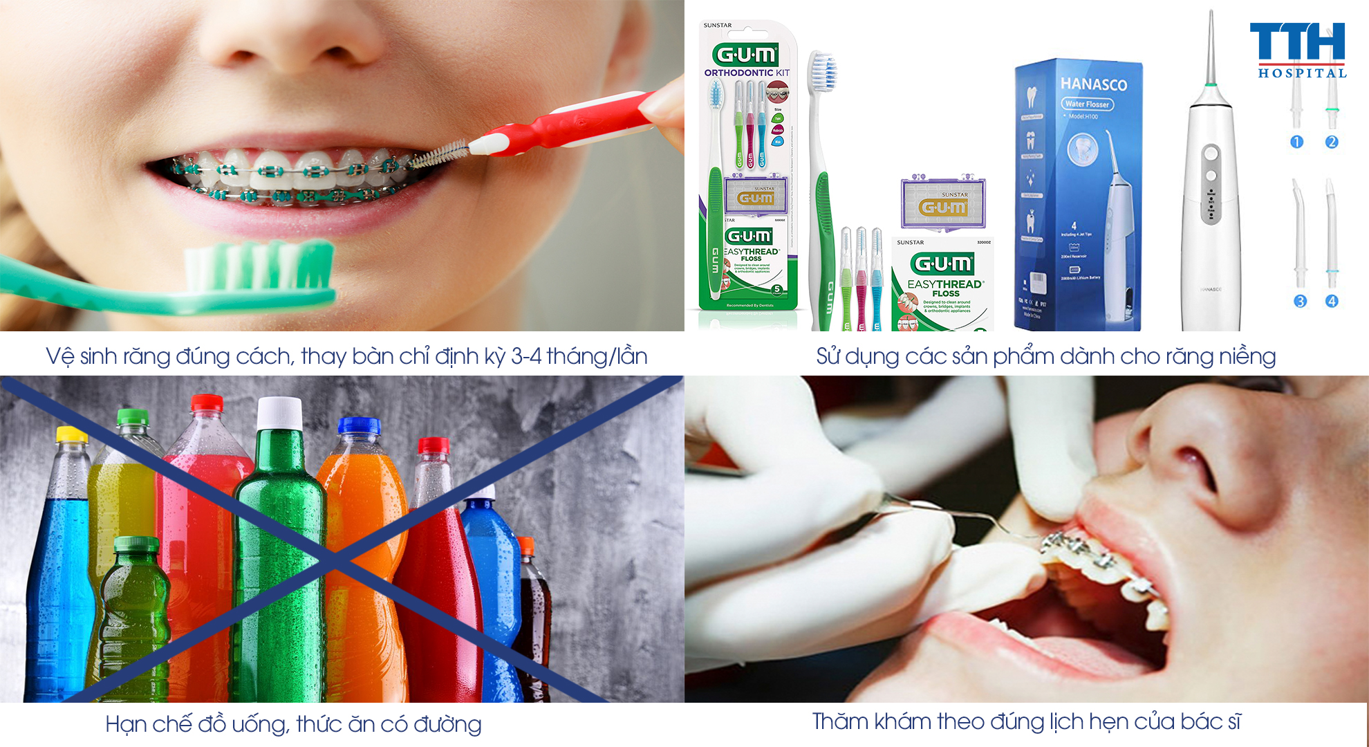 Vệ sinh đúng cách để răng vẫn sạch sẽ ngay cả trong khi đang niềng