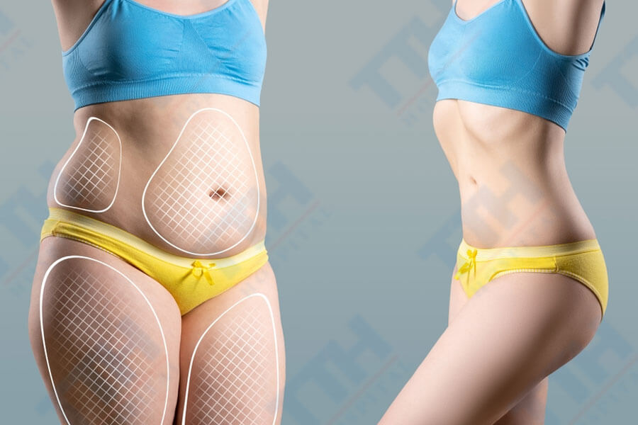 Ai là ứng viên phù hợp cho Body Jet
