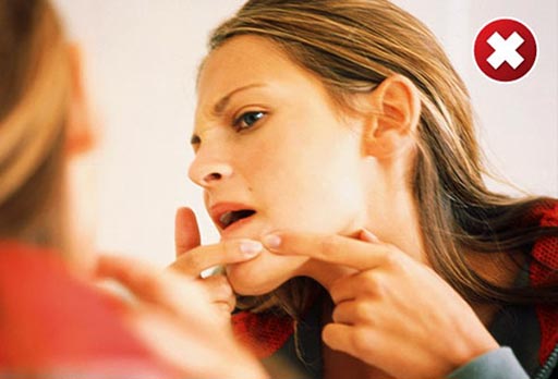 Không nặn mụn bằng tay hoặc bằng các dụng cụ chưa được sát khuẩn