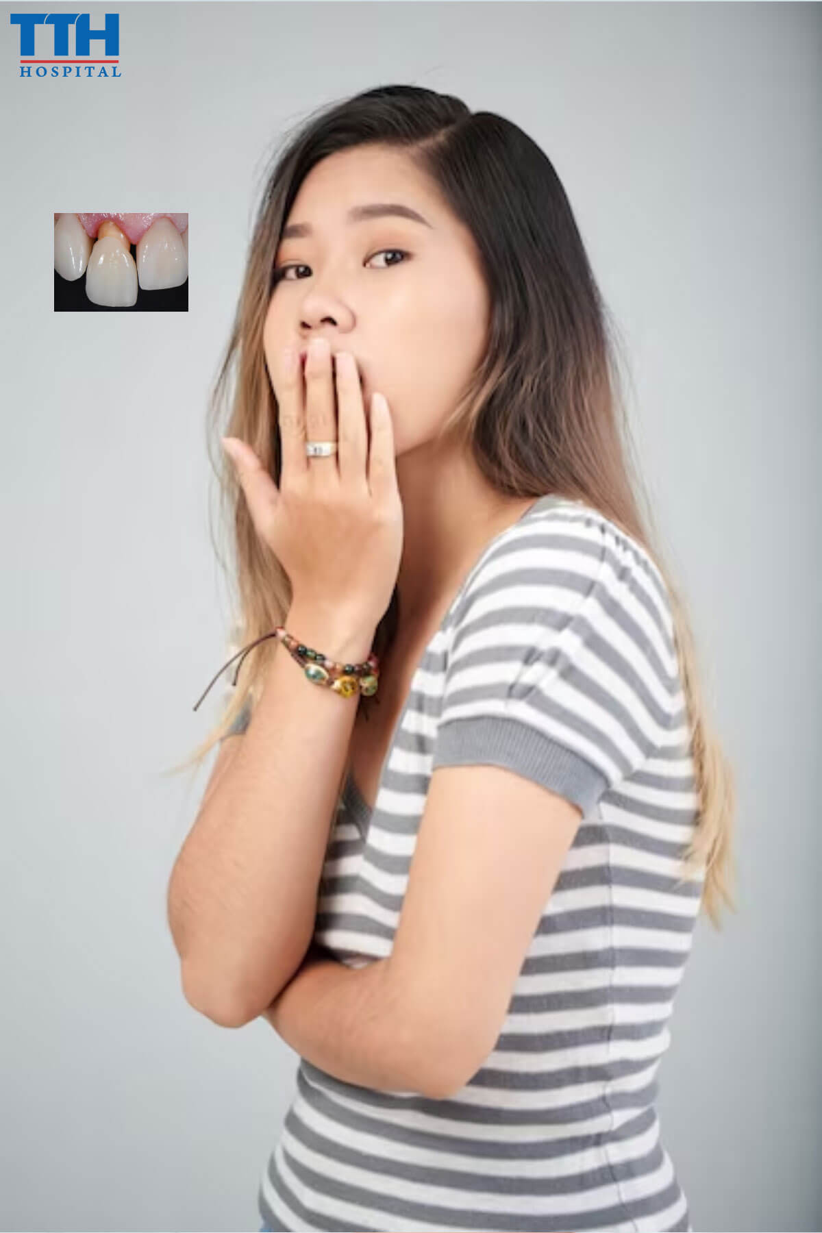 Bọc răng sứ giá rẻ kém bền vững và thẩm mỹ
