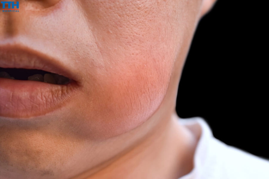 Các dấu hiệu và triệu chứng của dị ứng implant