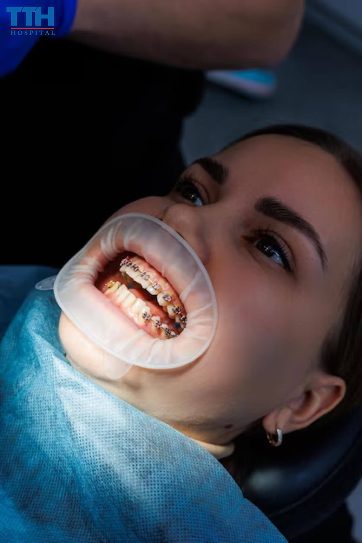 Các tiêu chí để đánh giá một nha khoa niềng răng tốt