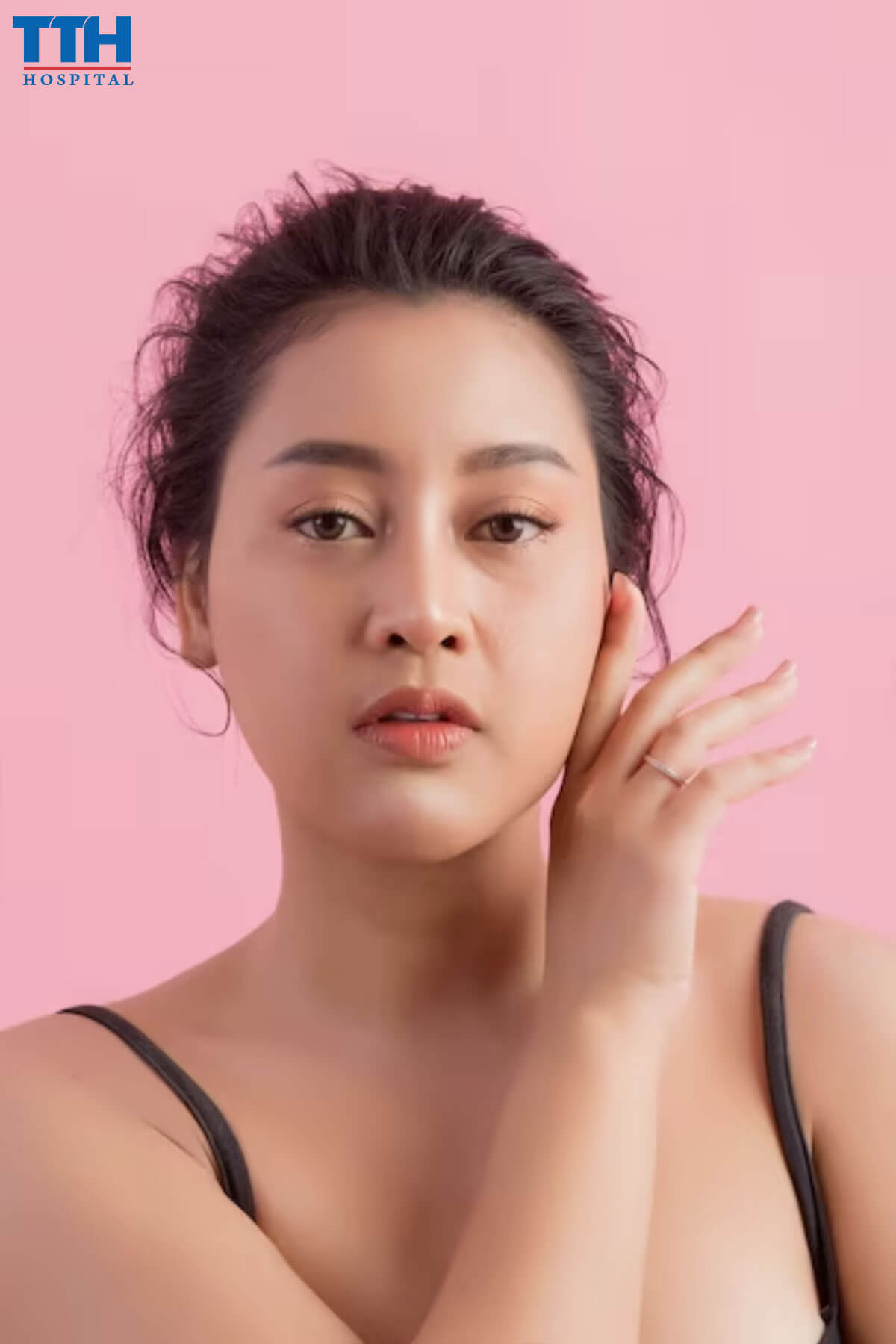 Cách ngăn ngừa nám da trị nám tại vinh nghệ an
