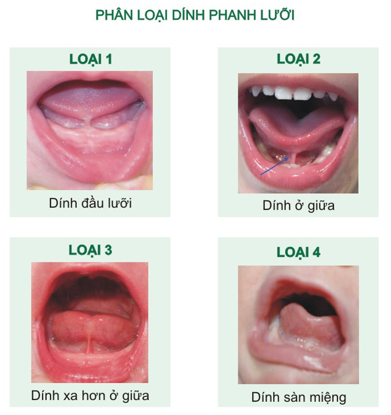 Đối tượng phù hợp