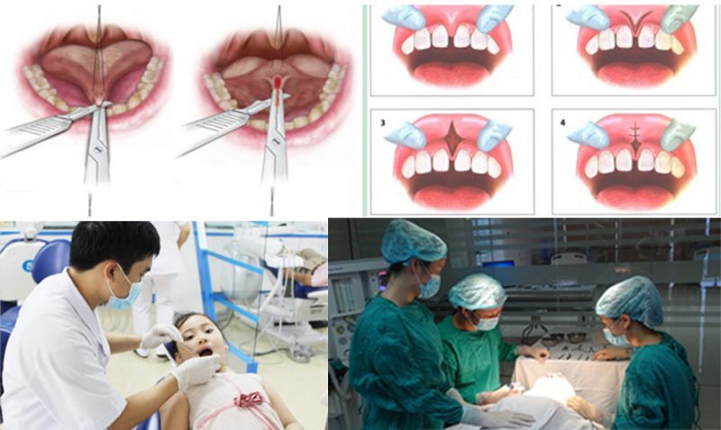 Ưu điểm vượt trội