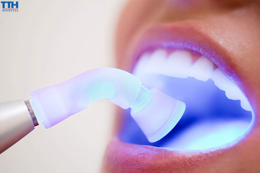 Chăm Sóc Răng Miệng Sau Khi Tẩy Trắng