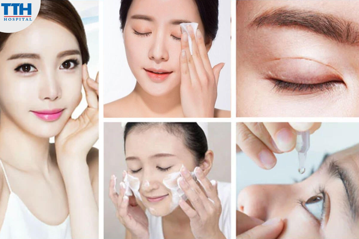 Chăm Sóc Vùng Mí Mắt Cẩn Thận sau cắt mí