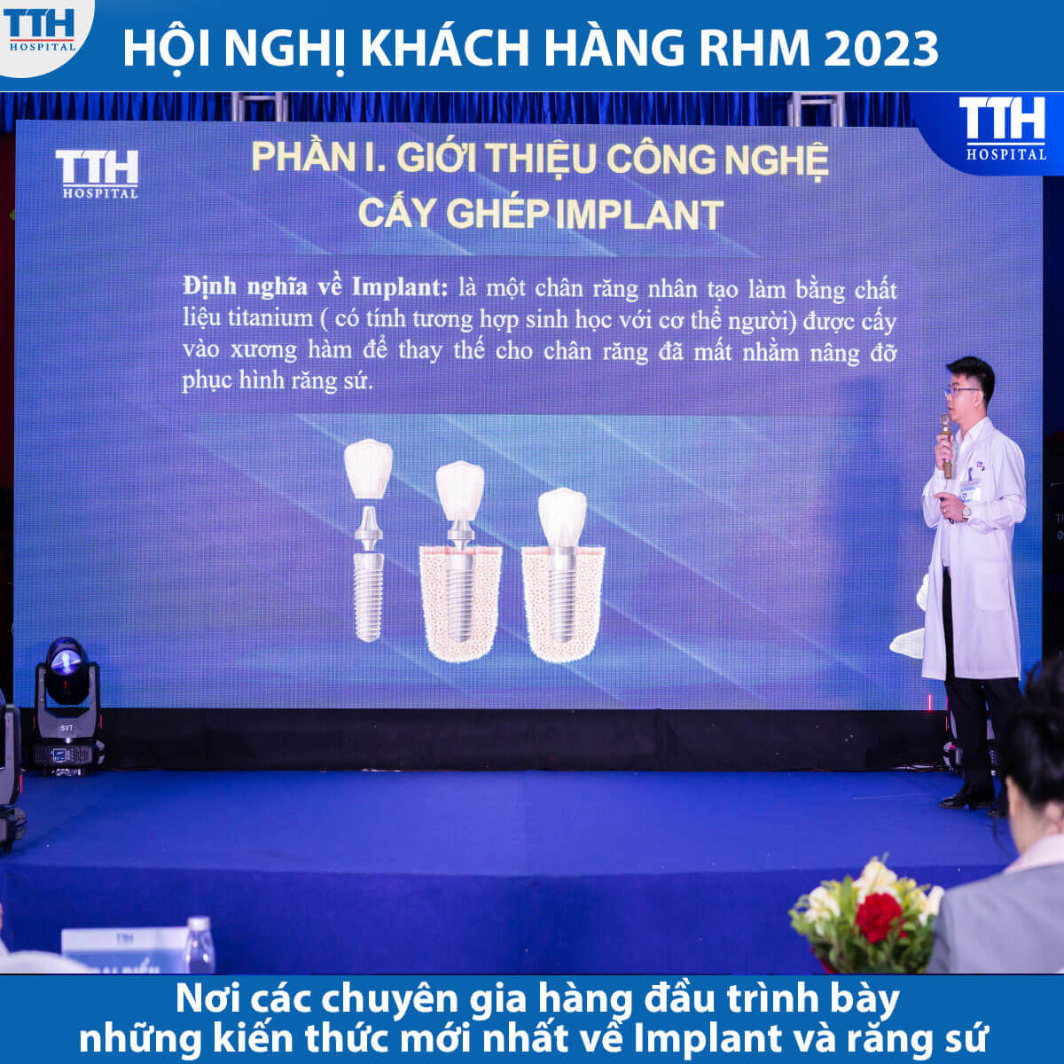 Khám Phá Công Nghệ Tiên Tiến - Định Hình Nụ Cười Hoàn Hảo