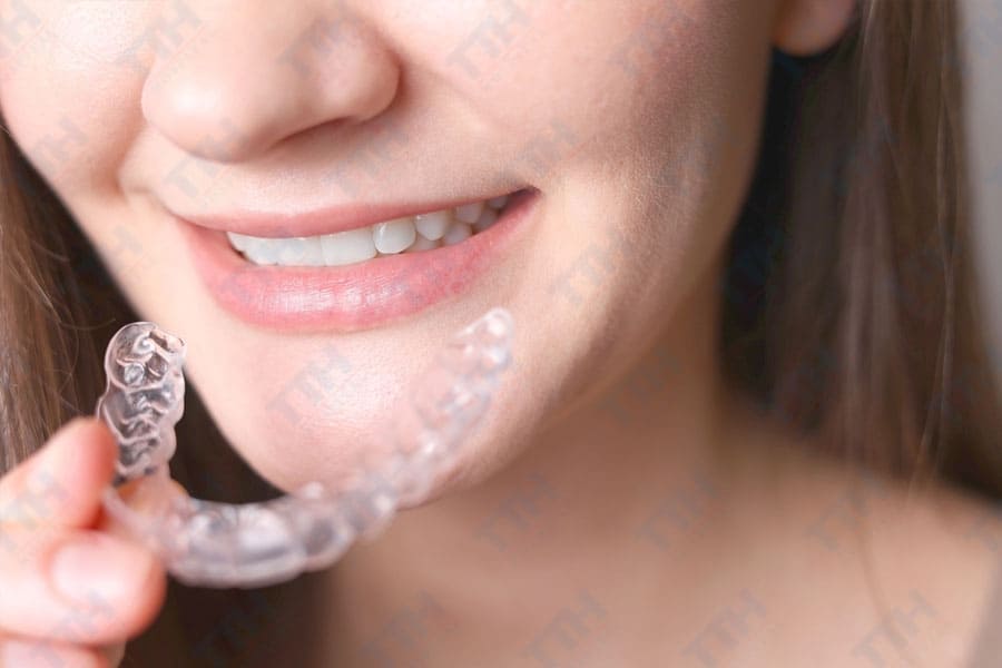 Có Nên Niềng Răng Invisalign 1 Hàm Không?