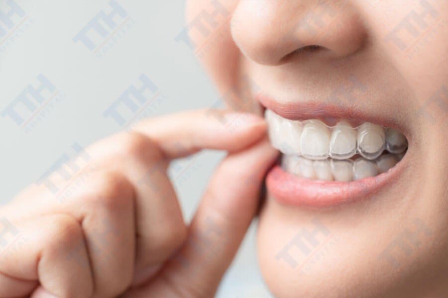 Công nghệ chỉnh nha trong suốt TTH Aligners đã mang đến một cuộc cách mạng trong lĩnh vực chỉnh nha