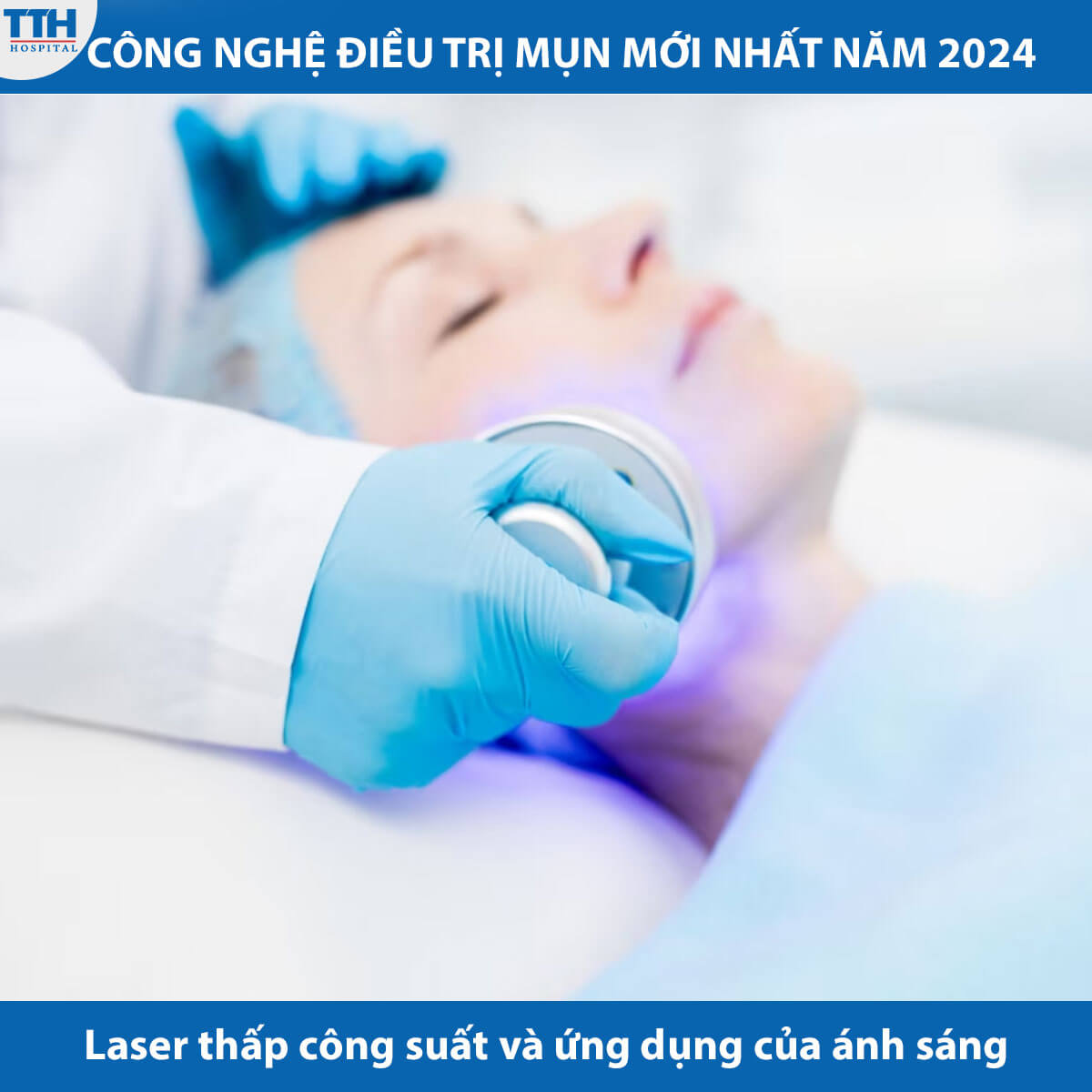 Laser thấp công suất và ứng dụng của ánh sáng trong điều trị mụn