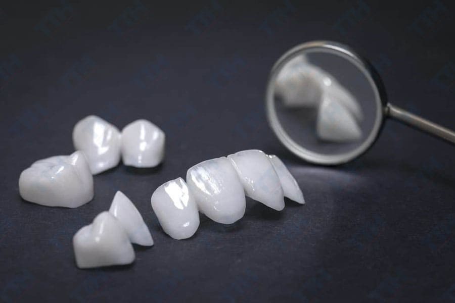 Công nghệ răng sứ Diamond Veneer – có gì đặc biệt?