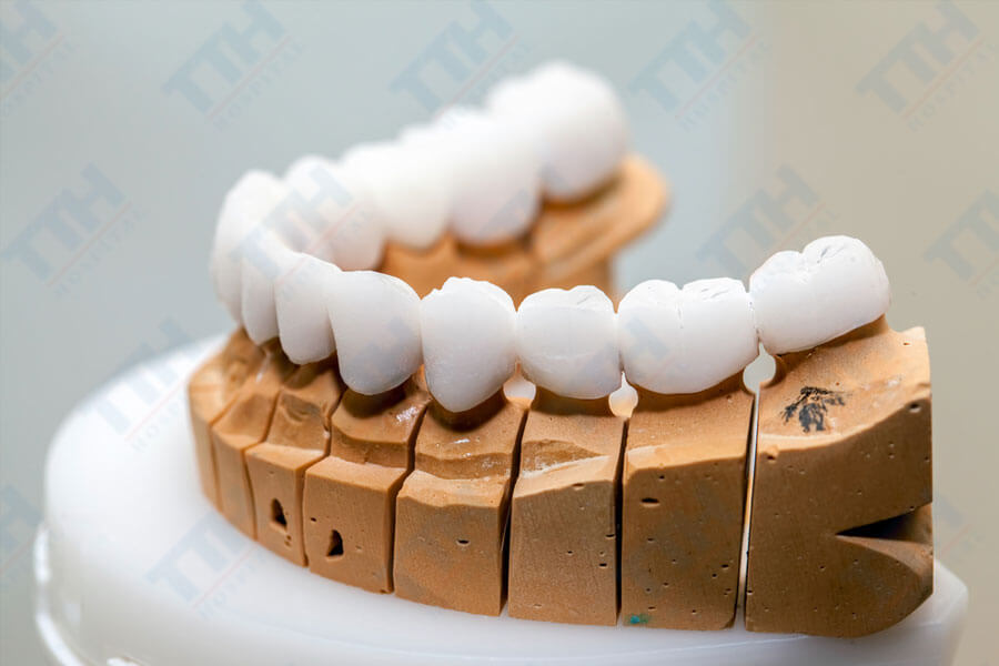 Đặc điểm của răng sứ Noritake