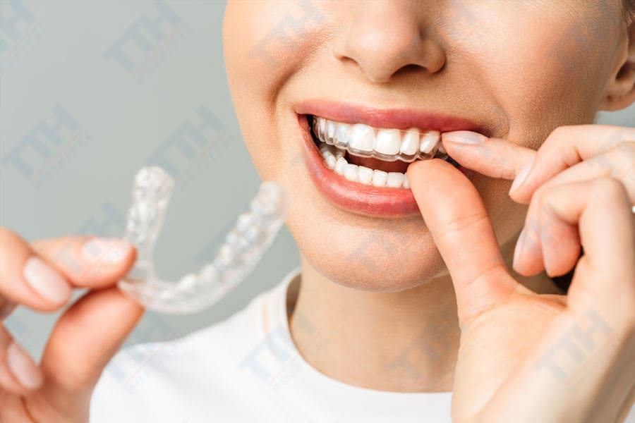Đạt Được Khớp Cắn Chuẩn