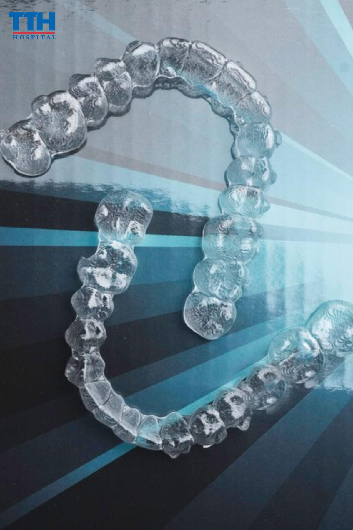 Vậy răng nào sẽ được nhổ khi niềng răng Invisalign?