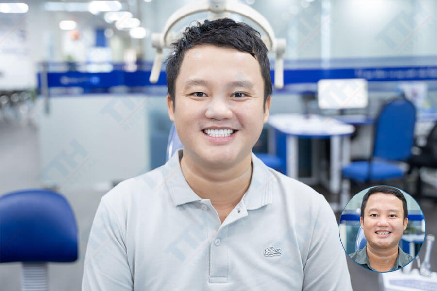 Dịch Vụ Răng Sứ Zirconia + Noritake Tại Bệnh Viện Thái Thượng Hoàng