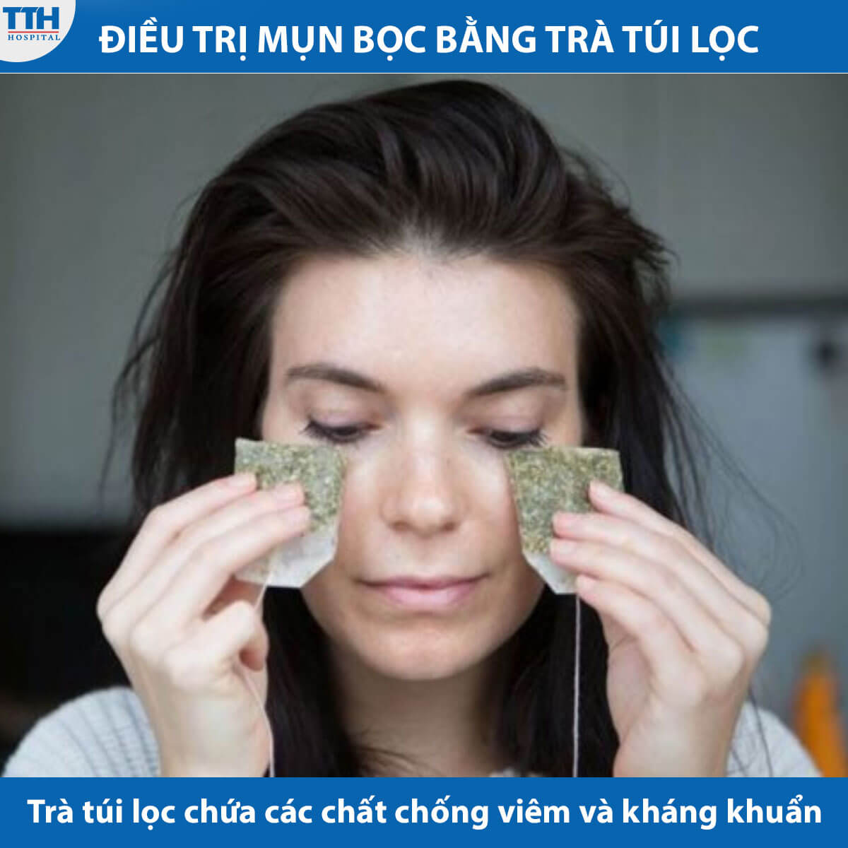 Điều trị mụn bọc bằng trà túi lọc