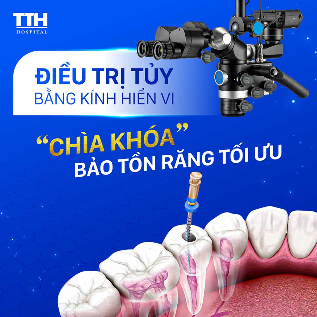 Điều trị tủy răng bằng kính hiển vi tại bệnh viện Thái Thượng Hoàng