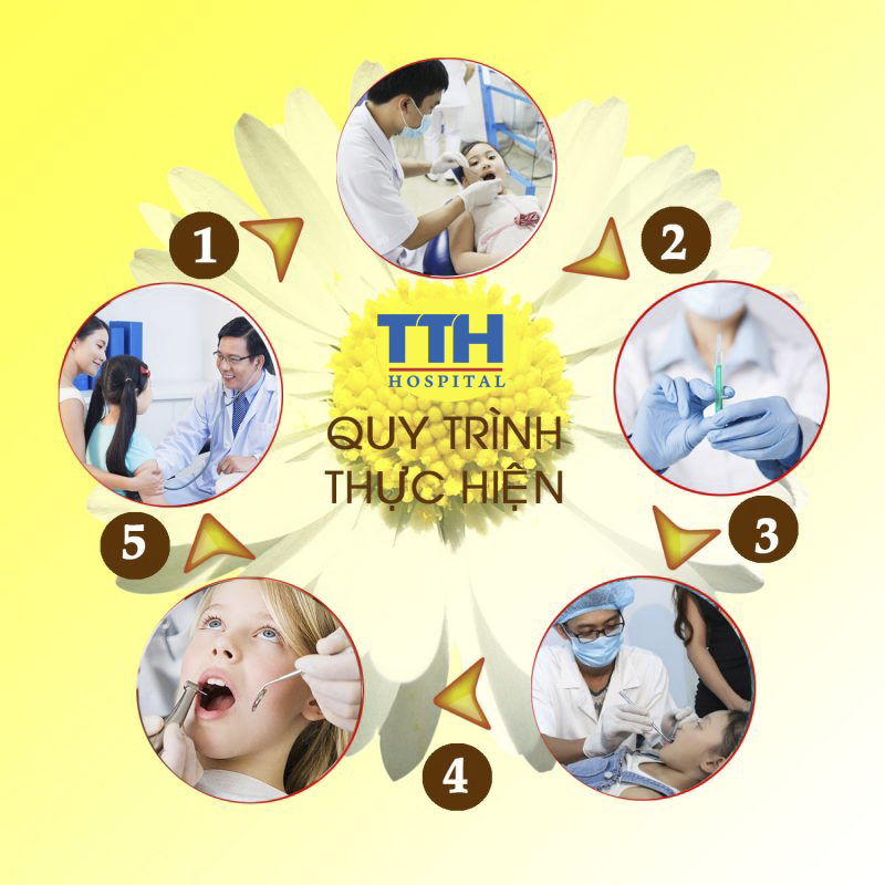 quy trình thục hiện