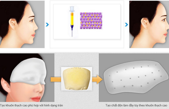ĐỐI TƯỢNG PHÙ HỢP ĐỘN TRÁN