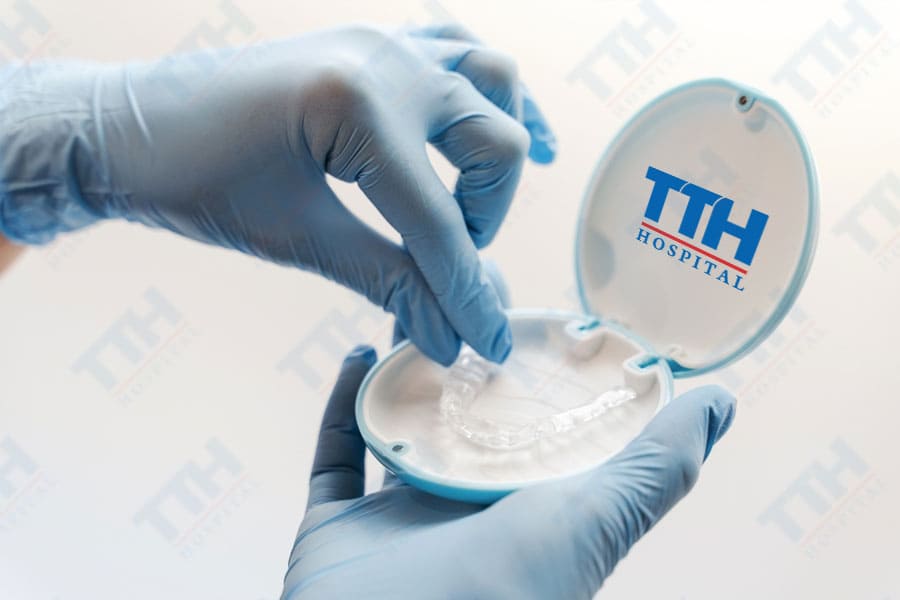 Giai đoạn chuẩn bị và thu thập dữ liệu cho việc niềng răng TTH Aligner