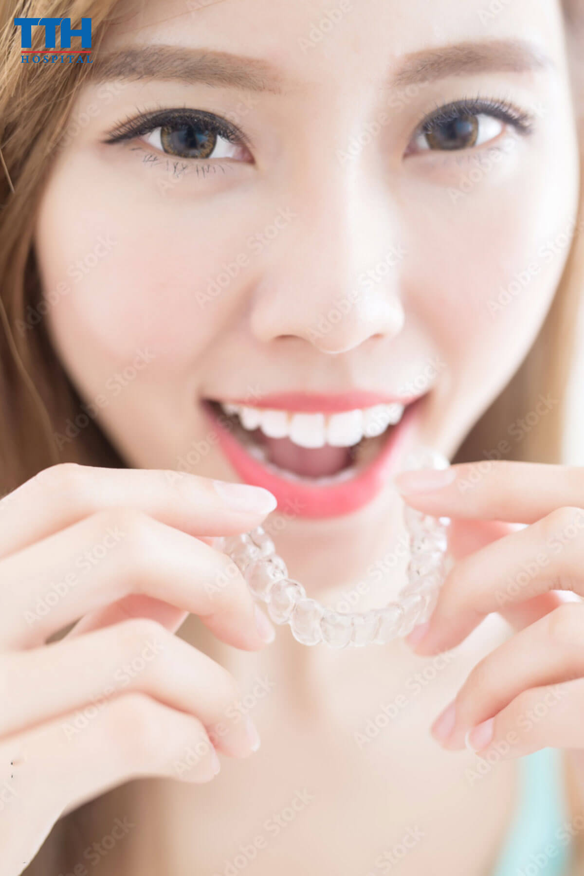 Cách Giảm Đau Khi Niềng Răng tại Vinh, Nghệ An - niềng răng tai vinh nghệ an