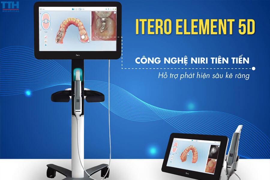 ITERO 5D Là Gì?